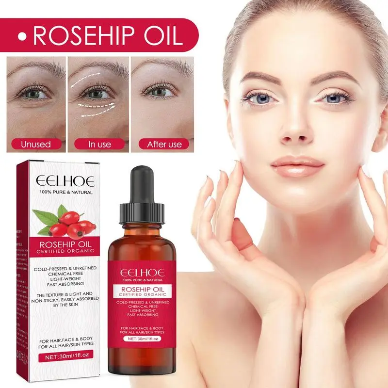 Face Oil Rosehip - 30ml Organic Rosehip Seed Oil For