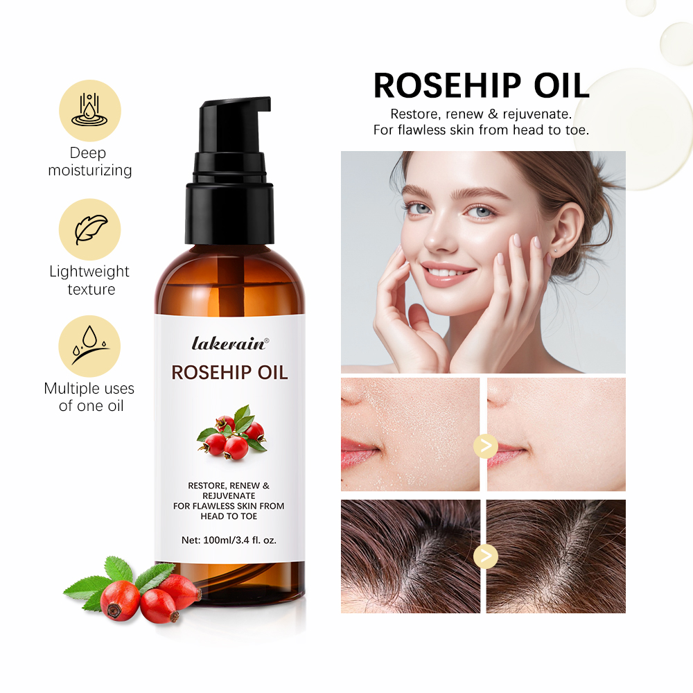 Face Oil Rosehip - 100ml Multifunction Moisturize Rosehip Essential Oil