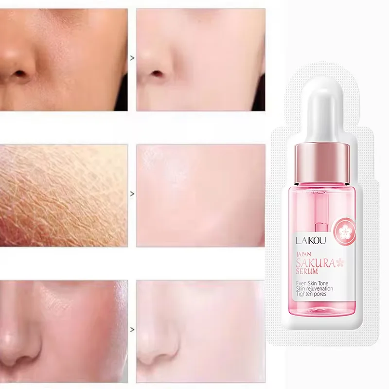 Sakura Whitening Face Serum An - Azelaic Acid Serum ulasan dan harga