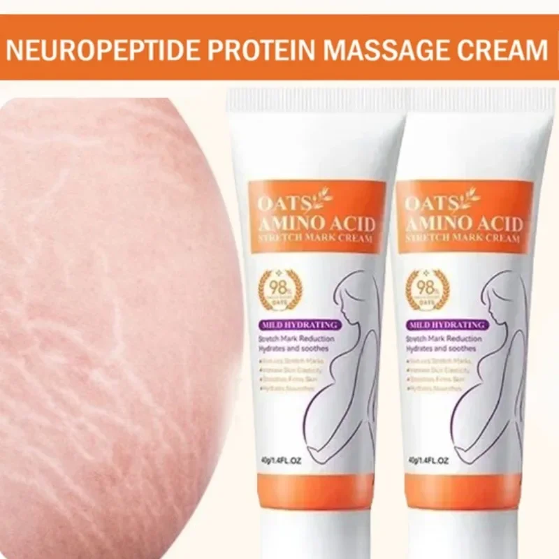 Stretch Marks Permanent Remova - Skincare Oat ulasan dan harga