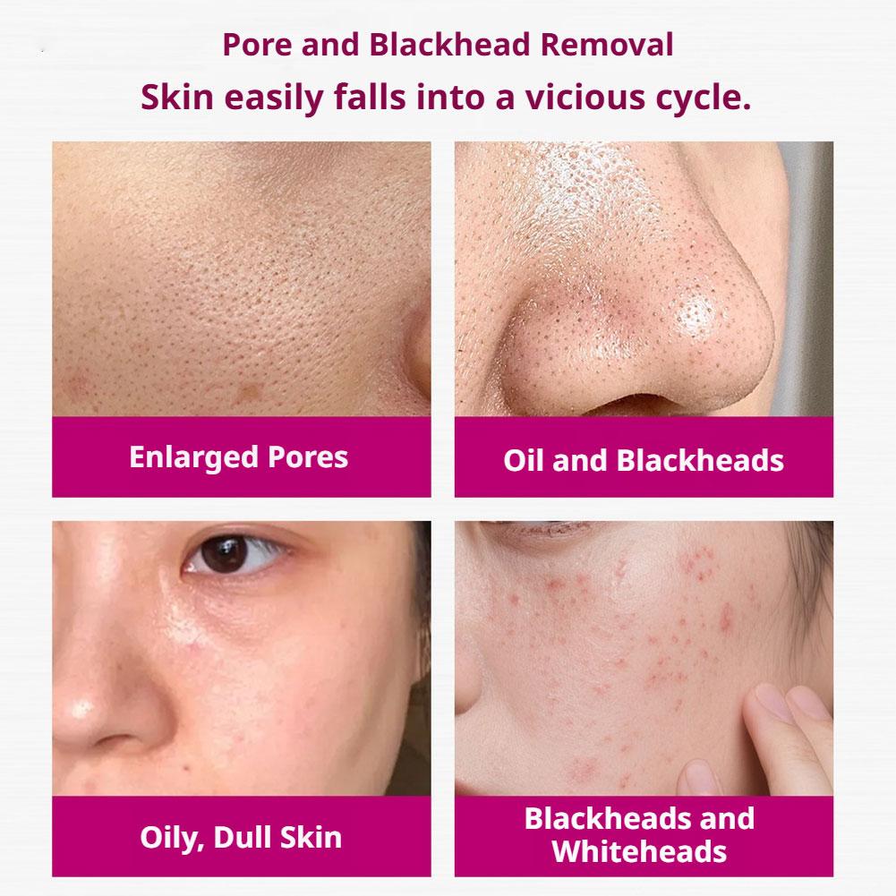 Salicylic Acid Shrink Pores Se - Azelaic Acid Serum ulasan dan harga