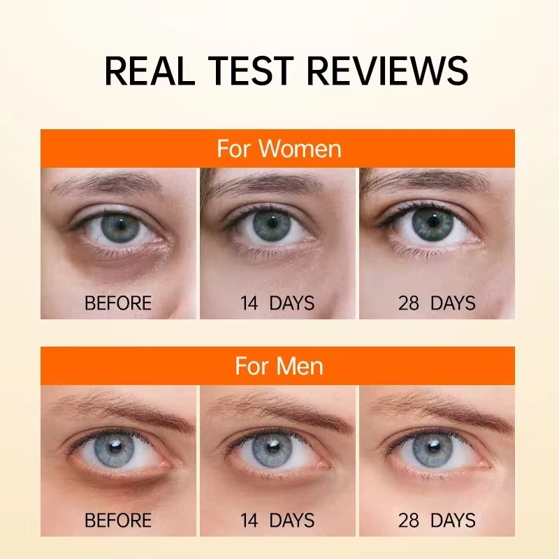 Anti Dark Circle Eye Serum Oil - Caffeine Eye Serum ulasan dan harga