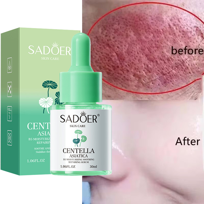 Facial Redness Repair Serum Im - Azelaic Acid Serum ulasan dan harga