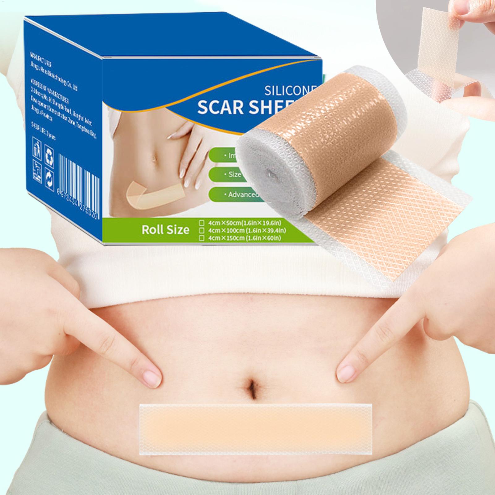1 Roll Silicone Scar Sheets 4c - Skincare Collagen ulasan dan harga